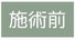 施術前