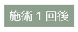 施術１回後